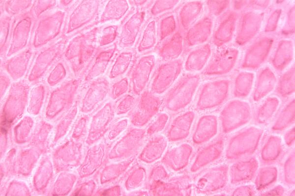 What Are the 3 Stem Cell Types? - Embryonic stem cells (ESCs)
