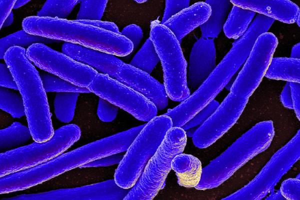 What are the Differences Between Viruses and Bacteria? - Similarities between viruses and bacteria