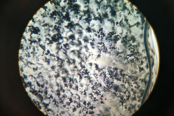 What Are Amyloplasts in Plant Cells? - What are amyloplasts?