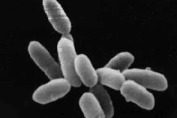What Organisms Are Classified Into the Archaea Domain? - What are archaea?